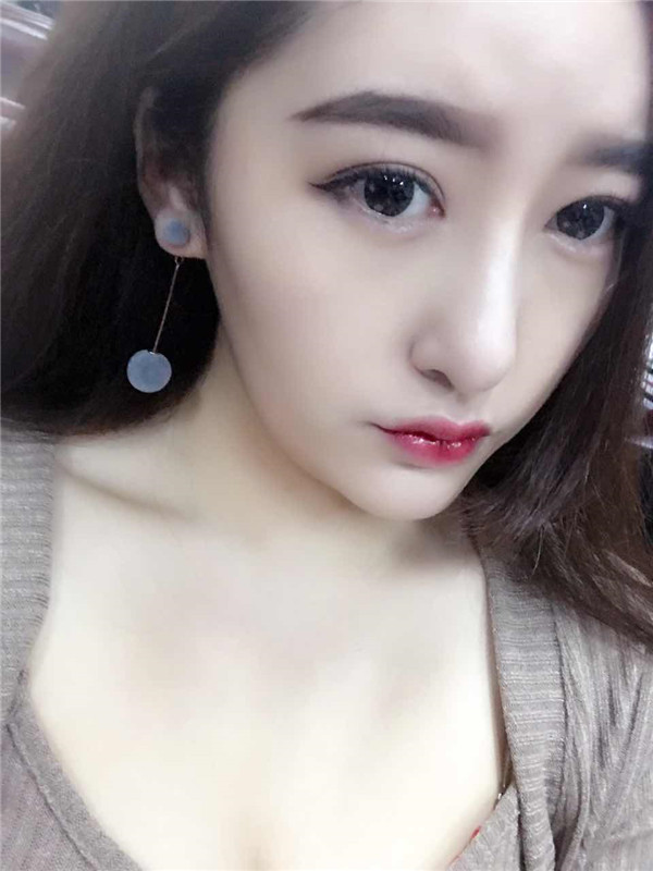 【硅胶隆鼻+耳软骨垫鼻尖】想让自己更完美就去做了隆鼻手术,果还较为的不错,和大家分享一下我的案例!