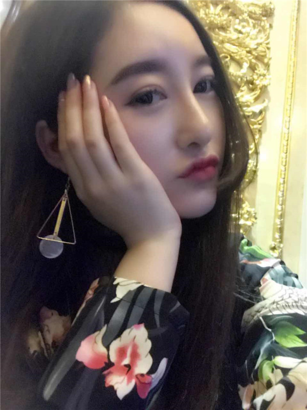 【硅胶隆鼻+耳软骨垫鼻尖】想让自己更完美就去做了隆鼻手术,果还较为的不错,和大家分享一下我的案例!