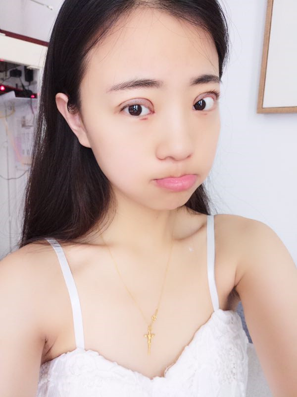 姐妹们,来看看我的双眼皮修复案例吧!看我修复的怎么样?之前失败的双眼皮手术给我留下了阴影,简直是花钱买罪受!