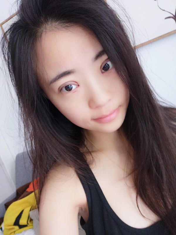 姐妹们,来看看我的双眼皮修复案例吧!看我修复的怎么样?之前失败的双眼皮手术给我留下了阴影,简直是花钱买罪受!
