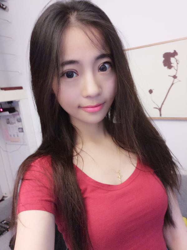 姐妹们,来看看我的双眼皮修复案例吧!看我修复的怎么样?之前失败的双眼皮手术给我留下了阴影,简直是花钱买罪受!