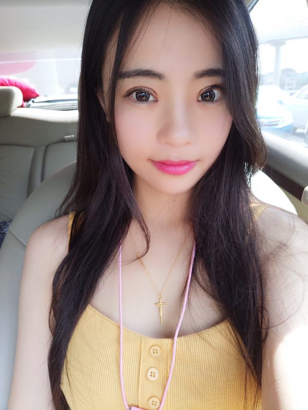 姐妹们,来看看我的双眼皮修复案例吧!看我修复的怎么样?之前失败的双眼皮手术给我留下了阴影,简直是花钱买罪受!