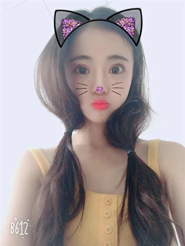 姐妹们,来看看我的双眼皮修复案例吧!看我修复的怎么样?之前失败的双眼皮手术给我留下了阴影,简直是花钱买罪受!