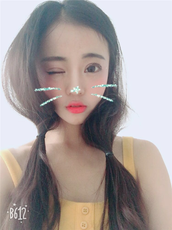 姐妹们,来看看我的双眼皮修复案例吧!看我修复的怎么样?之前失败的双眼皮手术给我留下了阴影,简直是花钱买罪受!