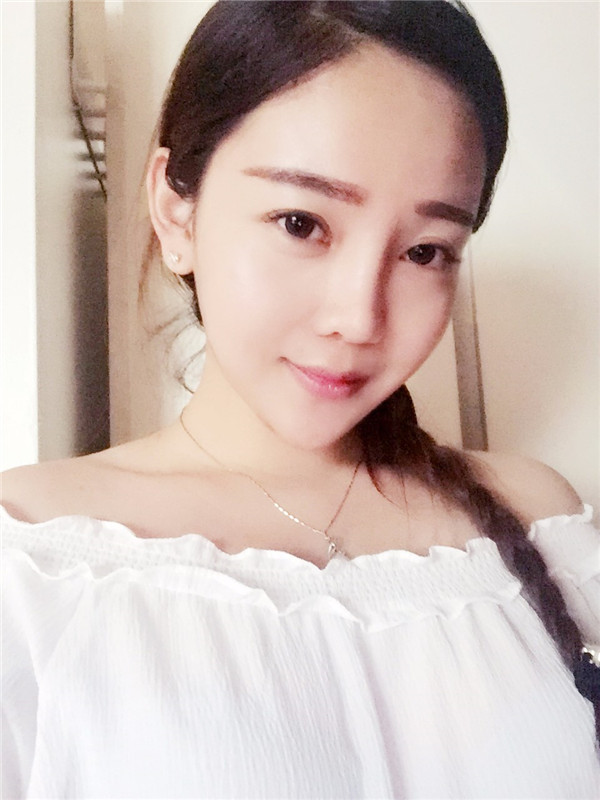 分享我的自体脂肪面部填充经历,我以前的面部情况真的是属于面部凹陷很严重的,整个人看起来真的很憔悴,自从做了面填之后就真的完全改善了我的样貌!