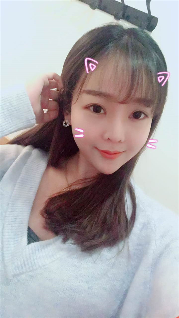 分享我的自体脂肪面部填充经历,我以前的面部情况真的是属于面部凹陷很严重的,整个人看起来真的很憔悴,自从做了面填之后就真的完全改善了我的样貌!