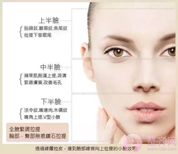 做埋线提升,问老公,一问全剧终!