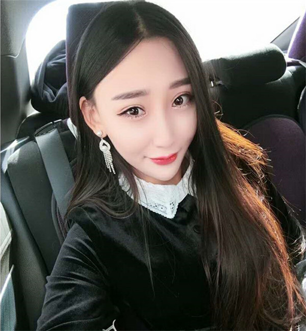 【割双眼皮+开眼角分享】哈喽,我较近去做了双眼皮外加开内眼角,其实我是很怕的,但是为了漂亮再拍也要克服啦!!