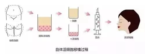世界就是这么玄幻,肥肉也能“变废为宝”!