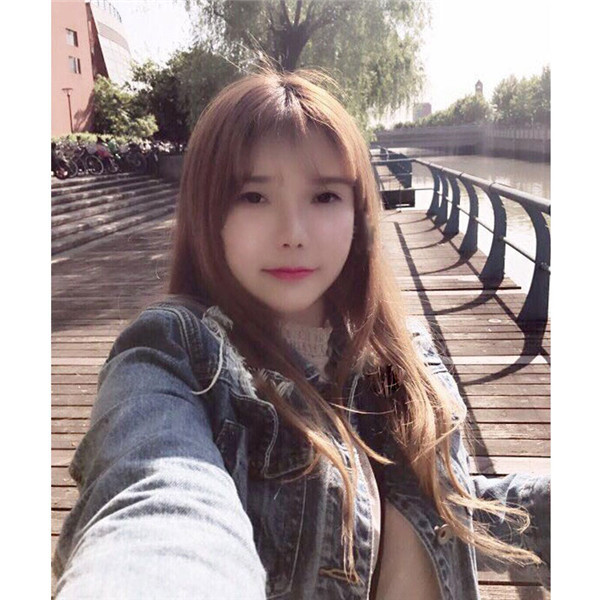 姐妹们,我做了【自体脂肪填充脸部】。填充部位有:太阳穴、眉弓、额头、面颊、泪沟、下巴。哈哈来看看我的变化吧~~