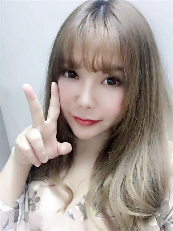 姐妹们,我做了【自体脂肪填充脸部】。填充部位有:太阳穴、眉弓、额头、面颊、泪沟、下巴。哈哈来看看我的变化吧~~
