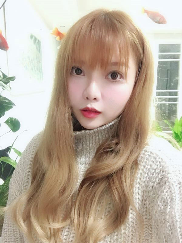 姐妹们,我做了【自体脂肪填充脸部】。填充部位有:太阳穴、眉弓、额头、面颊、泪沟、下巴。哈哈来看看我的变化吧~~