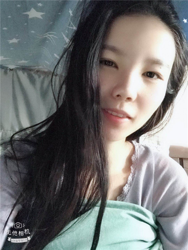 美女们,来看看我的耳软骨隆鼻案例吧!大家进来看看我做的怎么样啊?术后恢复很重要哦~~~