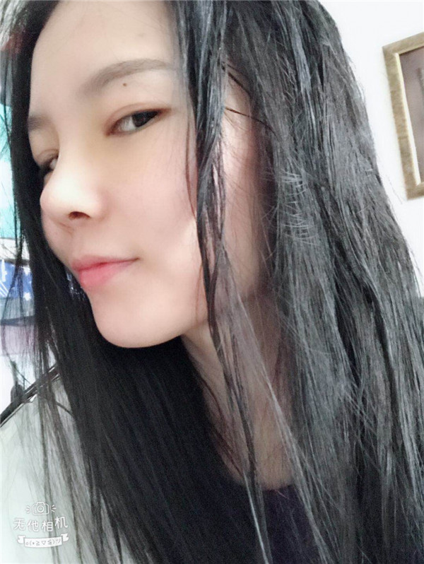 美女们,来看看我的耳软骨隆鼻案例吧!大家进来看看我做的怎么样啊?术后恢复很重要哦~~~