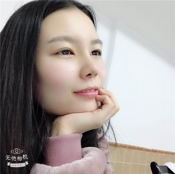 美女们,来看看我的耳软骨隆鼻案例吧!大家进来看看我做的怎么样啊?术后恢复很重要哦~~~