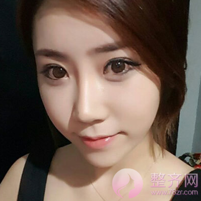 鼻头缩小手术果怎么样?
