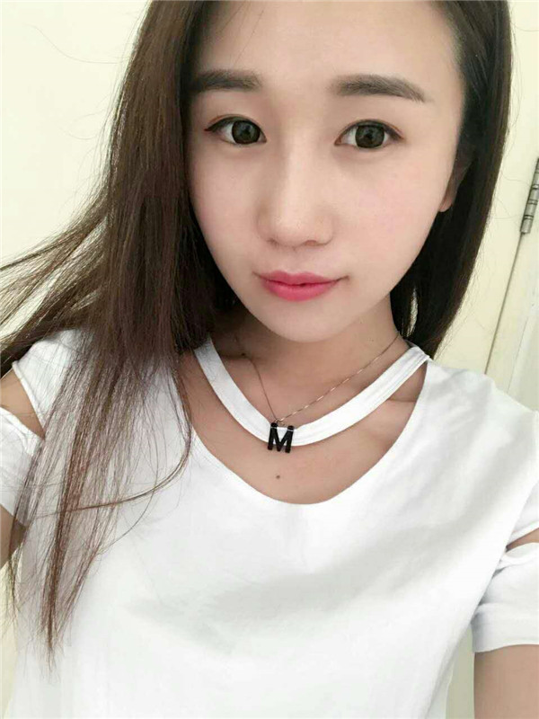 【福建膨体隆鼻】给大家看看我的膨体隆鼻案例,要么不做,要么就做一个好一点的!姐妹们,你们觉得我做的怎么样?