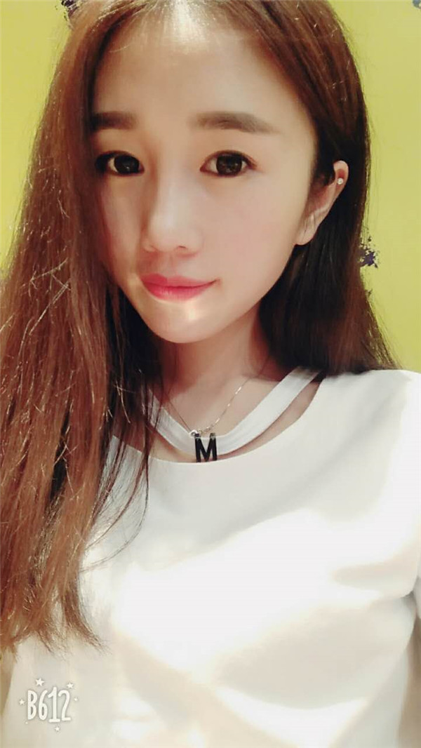 【福建膨体隆鼻】给大家看看我的膨体隆鼻案例,要么不做,要么就做一个好一点的!姐妹们,你们觉得我做的怎么样?