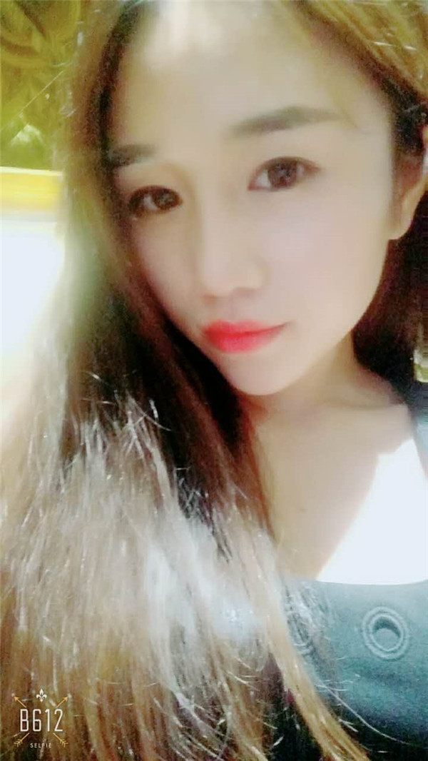 【福建膨体隆鼻】给大家看看我的膨体隆鼻案例,要么不做,要么就做一个好一点的!姐妹们,你们觉得我做的怎么样?