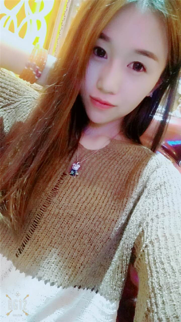 【福建膨体隆鼻】给大家看看我的膨体隆鼻案例,要么不做,要么就做一个好一点的!姐妹们,你们觉得我做的怎么样?