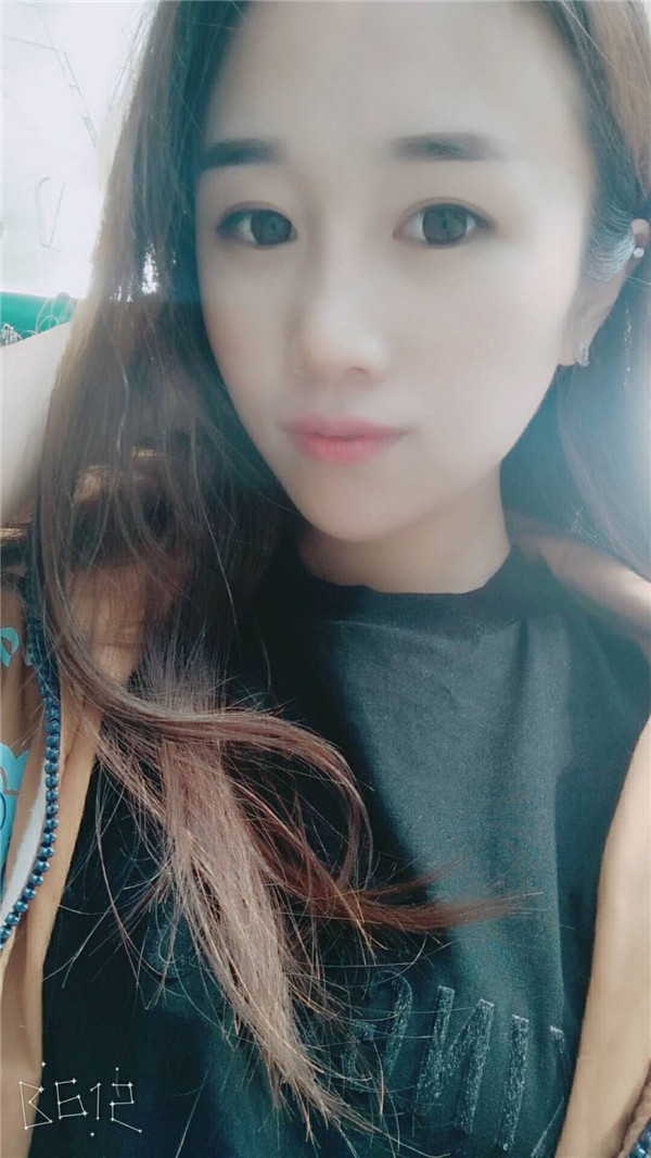 【福建膨体隆鼻】给大家看看我的膨体隆鼻案例,要么不做,要么就做一个好一点的!姐妹们,你们觉得我做的怎么样?