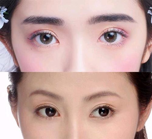 开眼角会回缩?是真的还是谣言?