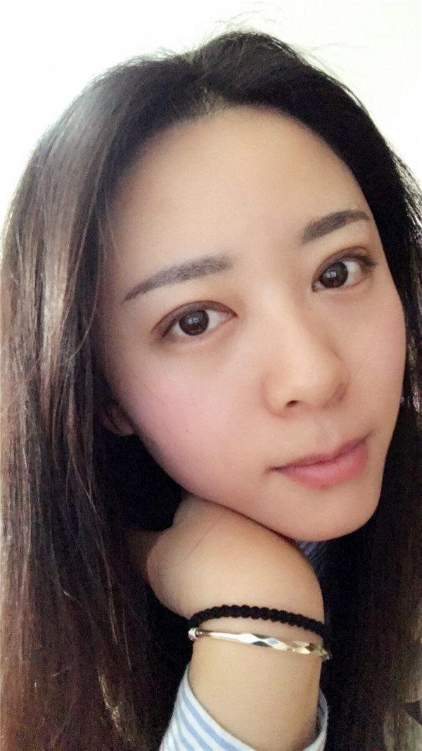 【广州埋线双眼皮案例】今天终于把一直想做的双眼皮做了！做了双眼皮的仙女们也要记得注意保护好眼部，较好等双眼皮消肿了再化妆哦~