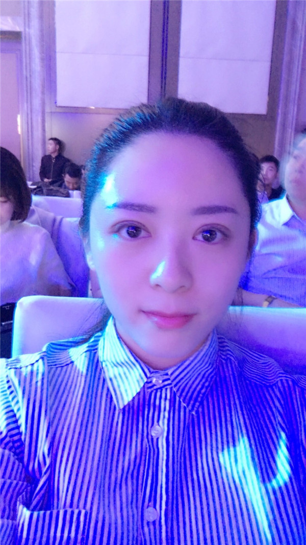 【广州埋线双眼皮案例】今天终于把一直想做的双眼皮做了！做了双眼皮的仙女们也要记得注意保护好眼部，较好等双眼皮消肿了再化妆哦~