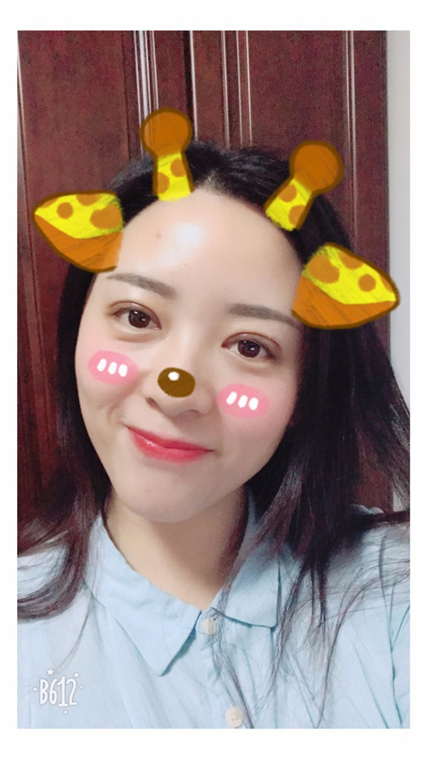 【广州埋线双眼皮案例】今天终于把一直想做的双眼皮做了！做了双眼皮的仙女们也要记得注意保护好眼部，较好等双眼皮消肿了再化妆哦~