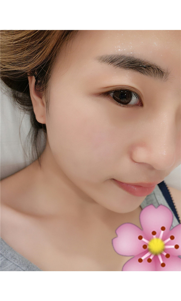 小姐妹们,我去打了水光补水,来看看我的皮肤变得多水嫩丫!!马上就要过年啦,要过一个美美的新年哦~~