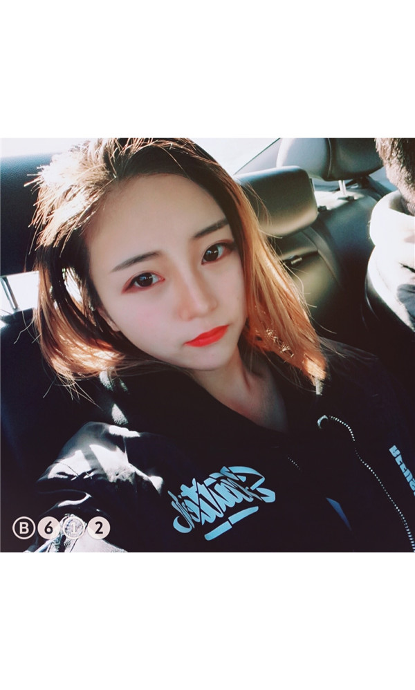 小姐妹们,我去打了水光补水,来看看我的皮肤变得多水嫩丫!!马上就要过年啦,要过一个美美的新年哦~~
