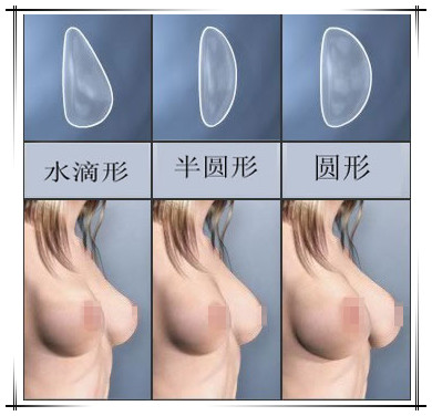 胸部隆多大好看形状如何呢?