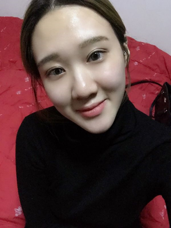 【眼部手术手术】宝宝们,大家好,我来啦~我做的是眼部手术,恢复的很好哦,进来看看我的经历吧!对你们很有帮助的