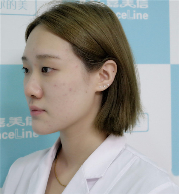 【眼部手术手术】宝宝们,大家好,我来啦~我做的是眼部手术,恢复的很好哦,进来看看我的经历吧!对你们很有帮助的