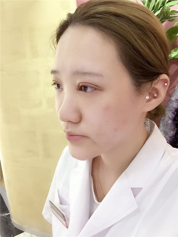 【眼部手术手术】宝宝们,大家好,我来啦~我做的是眼部手术,恢复的很好哦,进来看看我的经历吧!对你们很有帮助的