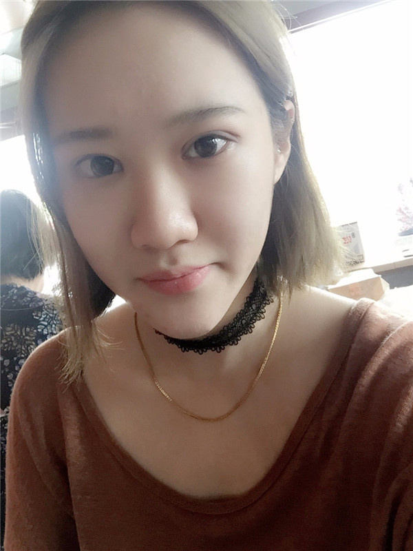 【眼部手术手术】宝宝们,大家好,我来啦~我做的是眼部手术,恢复的很好哦,进来看看我的经历吧!对你们很有帮助的