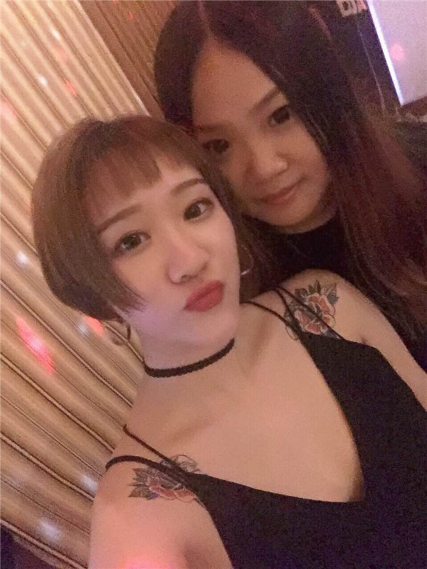 【眼部手术手术】宝宝们,大家好,我来啦~我做的是眼部手术,恢复的很好哦,进来看看我的经历吧!对你们很有帮助的