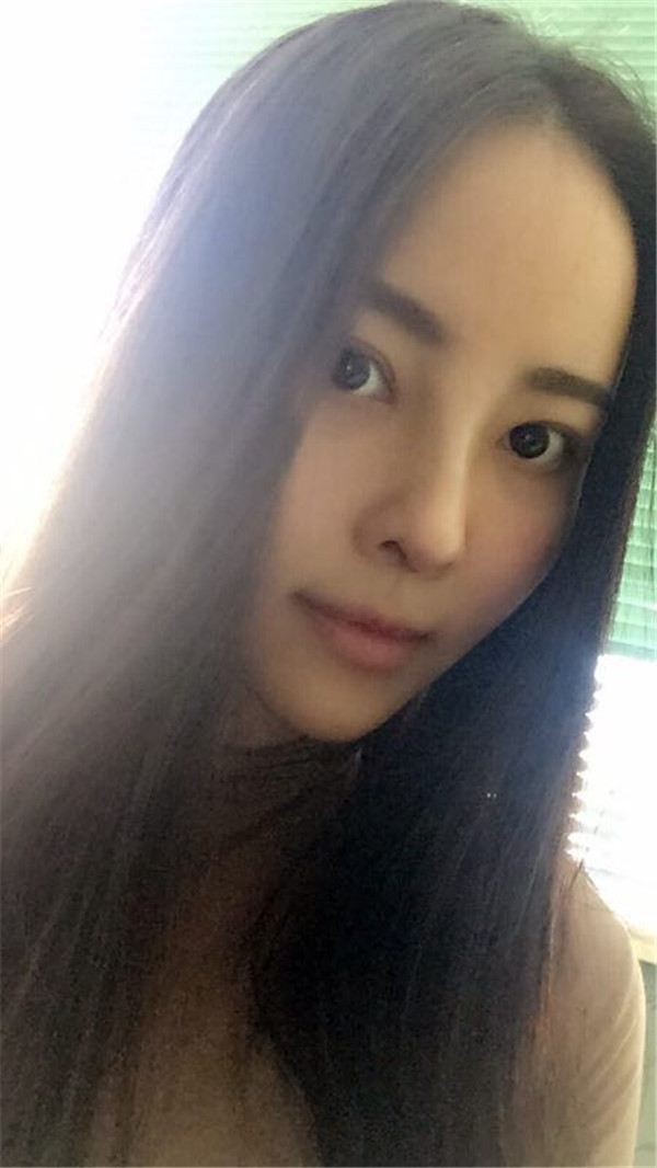 【我的假体隆鼻案例】新年快乐呀宝宝们,我来和大家分享我的隆鼻日记了,我自己恢复得不错,所以放心大胆的将自己的鼻子交给医院啦~