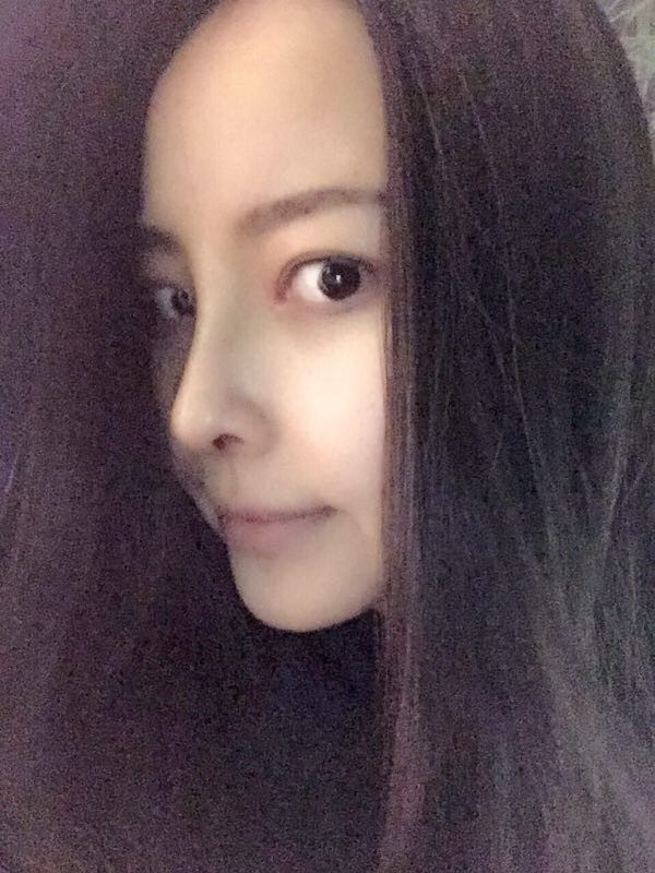 【我的假体隆鼻案例】新年快乐呀宝宝们,我来和大家分享我的隆鼻日记了,我自己恢复得不错,所以放心大胆的将自己的鼻子交给医院啦~