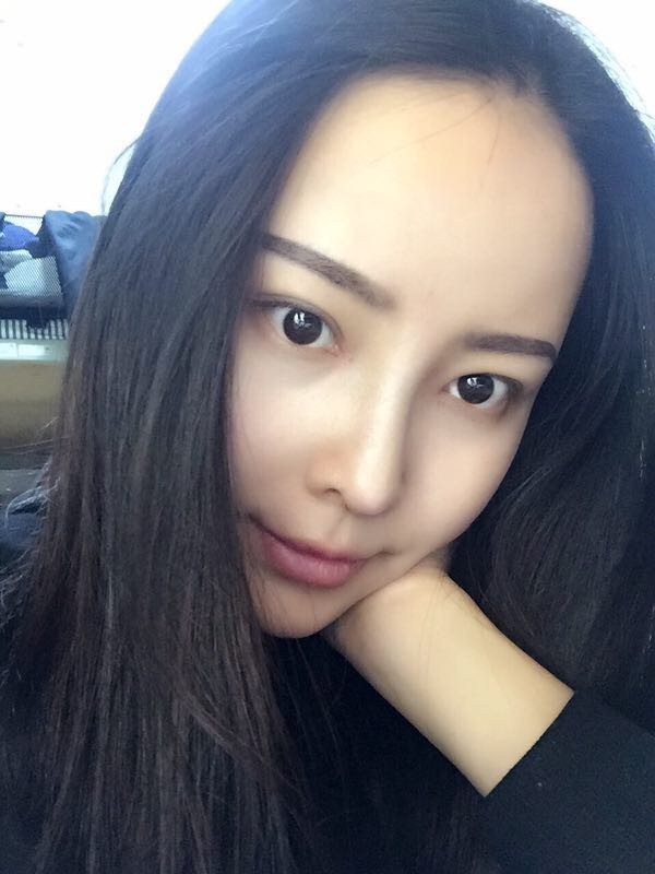 【我的假体隆鼻案例】新年快乐呀宝宝们,我来和大家分享我的隆鼻日记了,我自己恢复得不错,所以放心大胆的将自己的鼻子交给医院啦~
