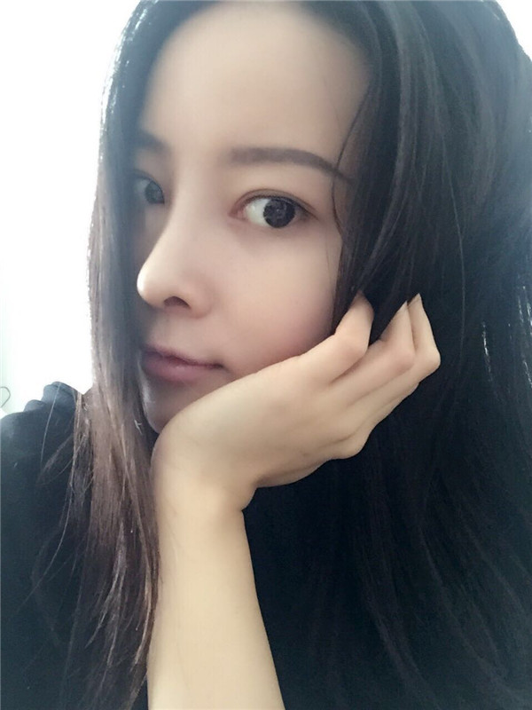 【我的假体隆鼻案例】新年快乐呀宝宝们,我来和大家分享我的隆鼻日记了,我自己恢复得不错,所以放心大胆的将自己的鼻子交给医院啦~