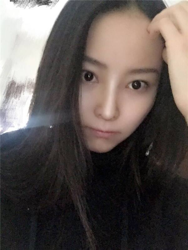 【我的假体隆鼻案例】新年快乐呀宝宝们,我来和大家分享我的隆鼻日记了,我自己恢复得不错,所以放心大胆的将自己的鼻子交给医院啦~