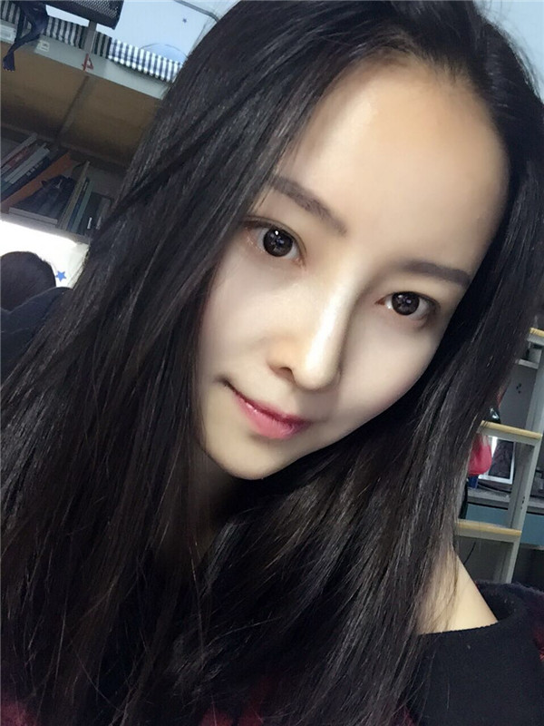 【我的假体隆鼻案例】新年快乐呀宝宝们,我来和大家分享我的隆鼻日记了,我自己恢复得不错,所以放心大胆的将自己的鼻子交给医院啦~