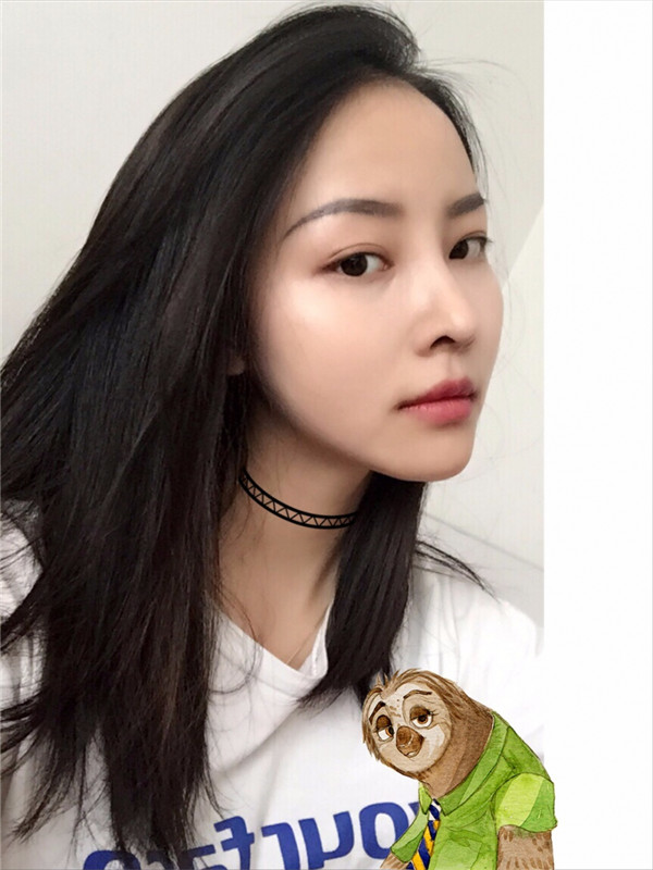 【我的假体隆鼻案例】新年快乐呀宝宝们,我来和大家分享我的隆鼻日记了,我自己恢复得不错,所以放心大胆的将自己的鼻子交给医院啦~