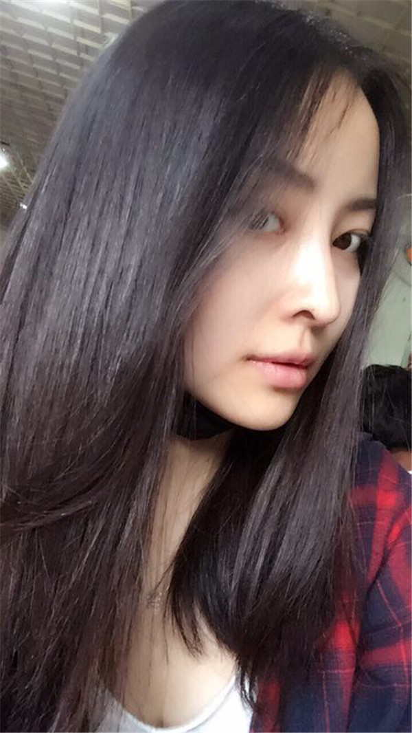 【我的假体隆鼻案例】新年快乐呀宝宝们,我来和大家分享我的隆鼻日记了,我自己恢复得不错,所以放心大胆的将自己的鼻子交给医院啦~