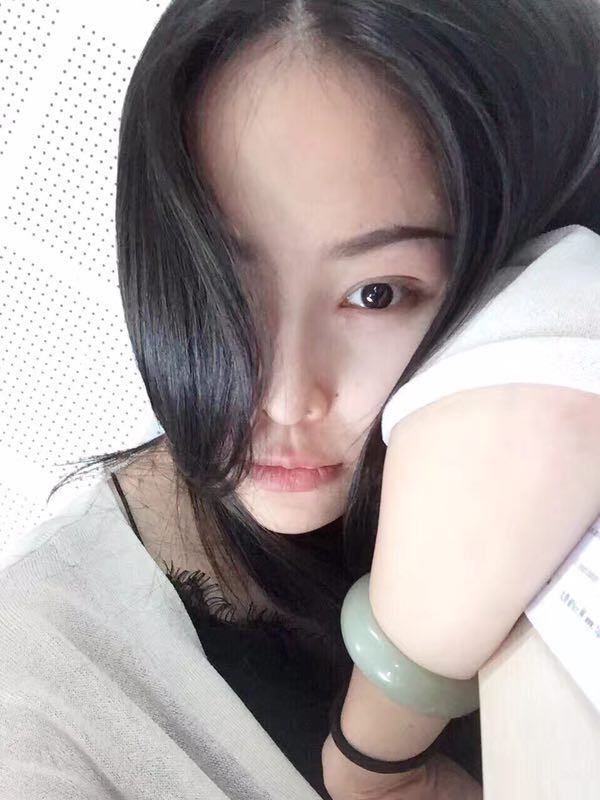 【我的假体隆鼻案例】新年快乐呀宝宝们,我来和大家分享我的隆鼻日记了,我自己恢复得不错,所以放心大胆的将自己的鼻子交给医院啦~