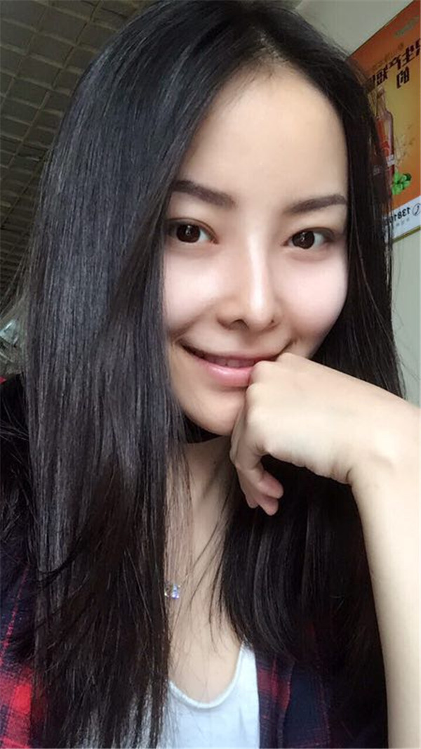 【我的假体隆鼻案例】新年快乐呀宝宝们,我来和大家分享我的隆鼻日记了,我自己恢复得不错,所以放心大胆的将自己的鼻子交给医院啦~
