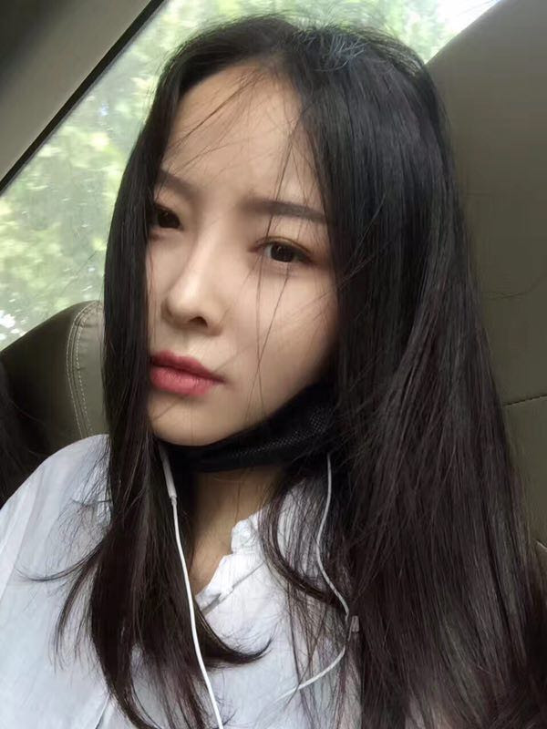 【我的假体隆鼻案例】新年快乐呀宝宝们,我来和大家分享我的隆鼻日记了,我自己恢复得不错,所以放心大胆的将自己的鼻子交给医院啦~