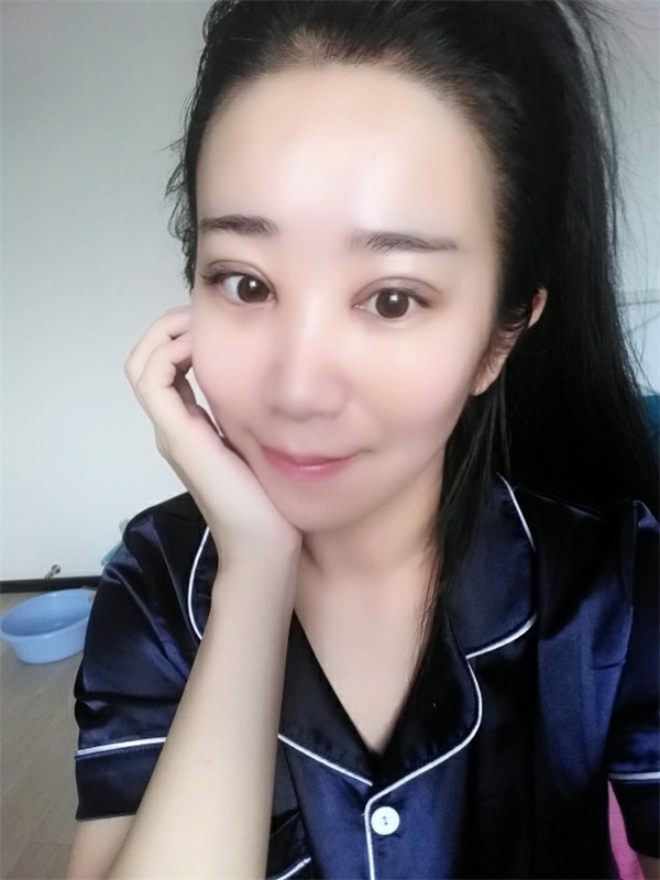 【分享案例】给宝宝们分享我的双眼皮之路啦!宝宝们我做双眼皮是打的局麻,其实局麻一点都不痛就跟蚊子叮差不多,不是特别注意完完全全就感觉不到