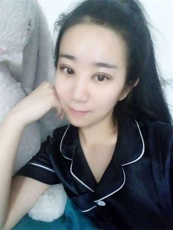【分享案例】给宝宝们分享我的双眼皮之路啦!宝宝们我做双眼皮是打的局麻,其实局麻一点都不痛就跟蚊子叮差不多,不是特别注意完完全全就感觉不到